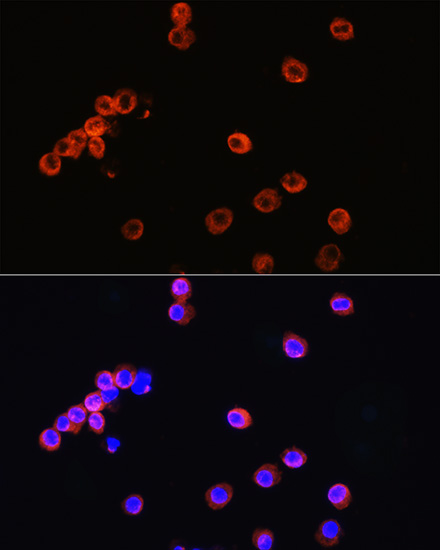 Immunofluorescence analysis of RAW264.7 cells using CD3E Antigen Polyclonal Antibody at dilution of  1:100. Blue: DAPI for nuclear staining.