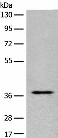 Western blot analysis of Jurkat cell lysate  using EN2 Polyclonal Antibody at dilution of 1:400