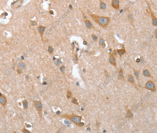 TP53BP2 Polyclonal Antibody - 3