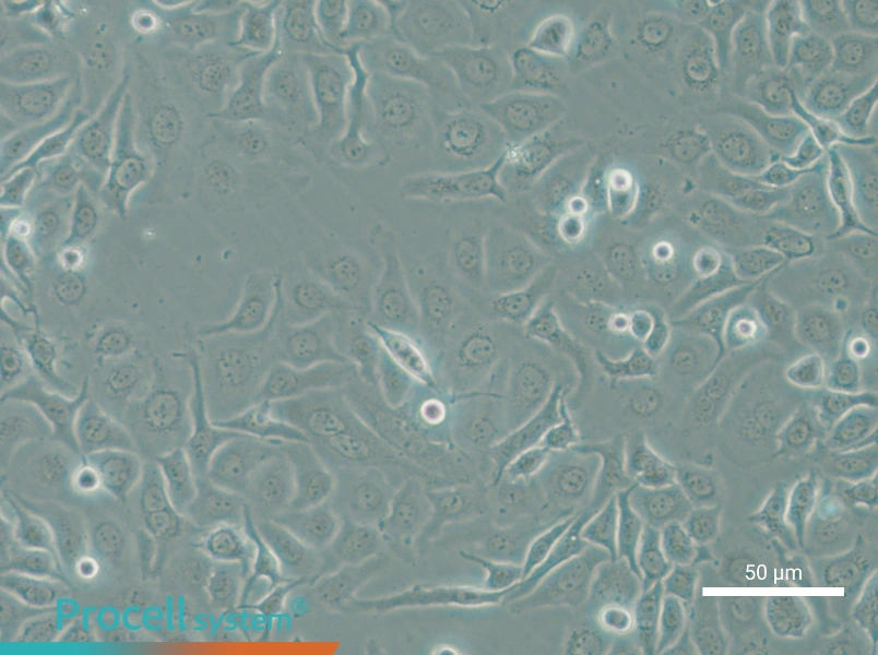 HCC1143 - 6