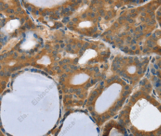TRIM3 Polyclonal Antibody - 2