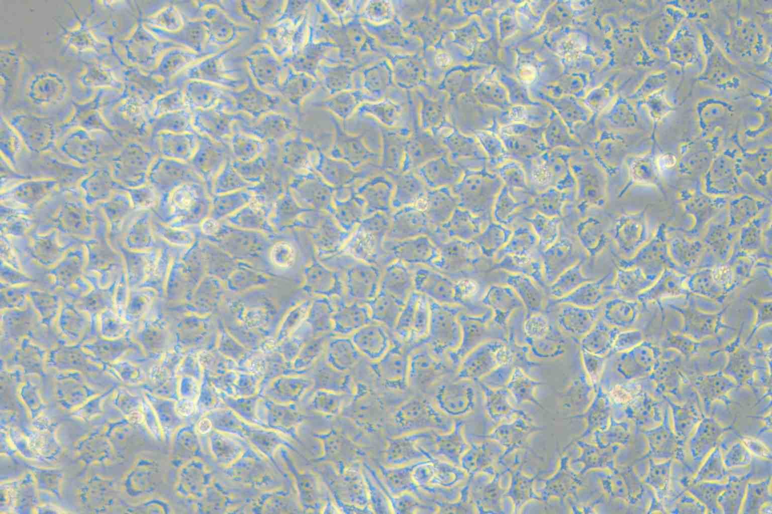 92-1 [Human uveal melanoma] Cell Complete Medium - small - 5