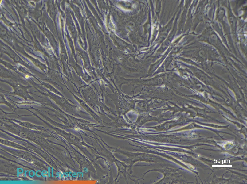 Human Endplate Chondrocyte Complete Medium - 6