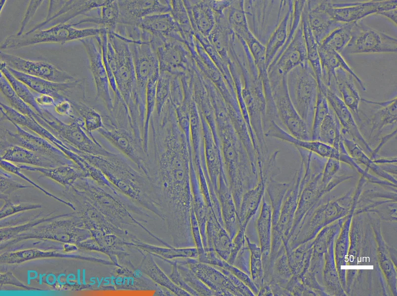 Human Uterine Fibroids Tissue-Derived Cell Complete Medium - 4