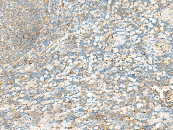 Immunohistochemistry of paraffin-embedded Human tonsil tissue  using HLA-DRB4 Polyclonal Antibody at dilution of 1:60(?200)