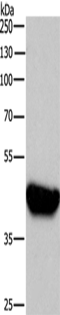 Western Blot analysis of A431  using BABAM2 Polyclonal Antibody at dilution of 1:750