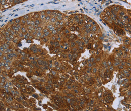 SNCG Polyclonal Antibody - 3