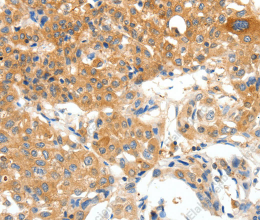 PLAT Polyclonal Antibody - 2