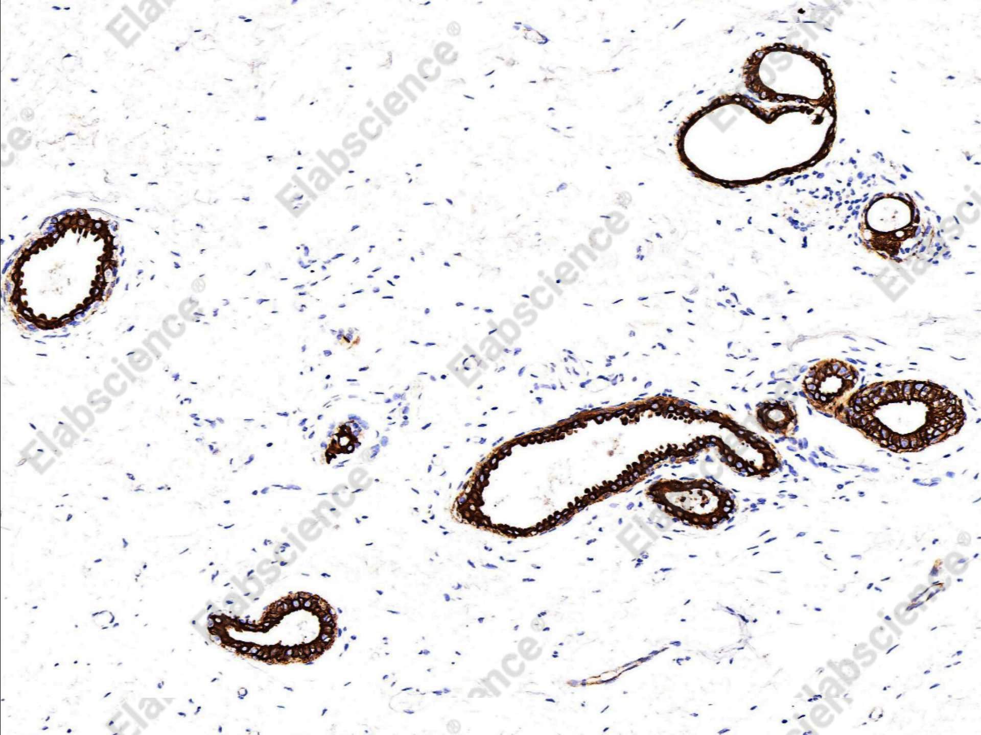 Recombinant Cytokeratin 7/KRT7 Monoclonal Antibody - 1