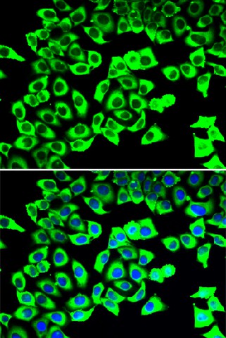 Immunofluorescence analysis of U2OS cells using RPLP2 Polyclonal Antibody