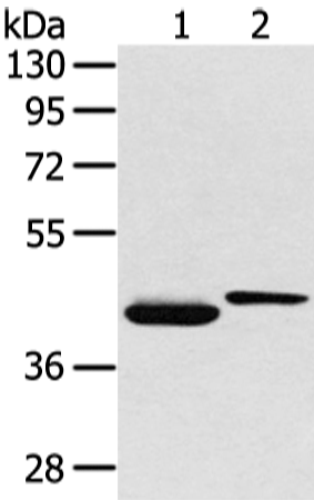 Western Blot analysis of Human lymphoma tissue  using BMP4 Polyclonal Antibody at dilution of 1:350