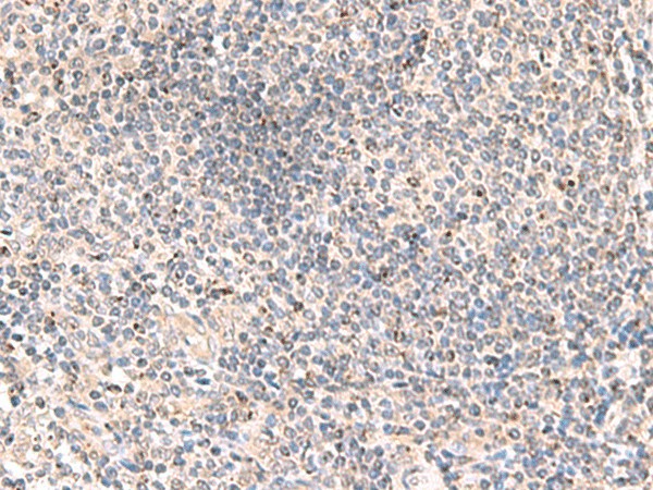 Immunohistochemistry of paraffin-embedded Human tonsil tissue  using MLKL Polyclonal Antibody at dilution of 1:85(?200)