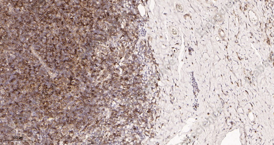 Recombinant Fas Monoclonal Antibody - 2