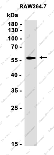 Recombinant PFKFB3 Monoclonal Antibody - 3