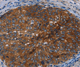 Catenin gamma Polyclonal Antibody - 2