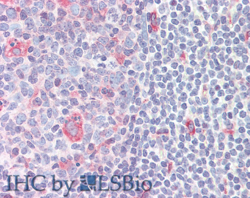 Immunohistochemistry of paraffin-embedded Small Intestine (MALT) tissue using CD272 Polyclonal Antibody at dilution of 1:50 (Elabscience Product Detected by Lifespan).