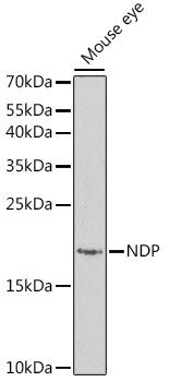 Western blot analysis of extracts of Mouse eye using NDP Polyclonal Antibody at dilution of 1:1000.