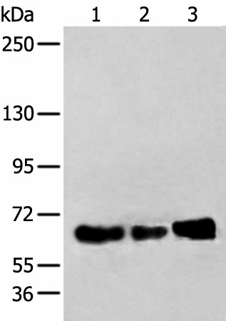 Western blot analysis of TM4 K562 and A431 cell lysates  using ZBTB5 Polyclonal Antibody at dilution of 1:250