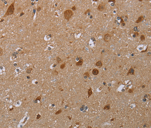 Immunohistochemistry of paraffin-embedded Human brain tissue using MARK1 Polyclonal Antibody at dilution 1:30