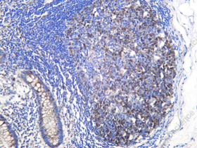 Recombinant Thymidine Kinase Monoclonal Antibody - 1
