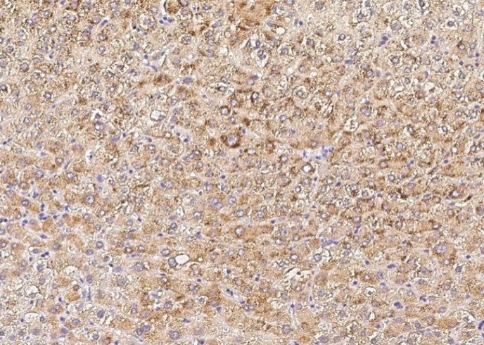 Recombinant PMVK/phosphomevalonate kinase Monoclonal Antibody - small - 3