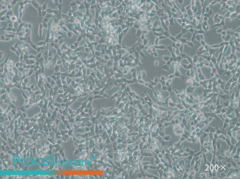 IMR-32 Cell Complete Medium - small - 6