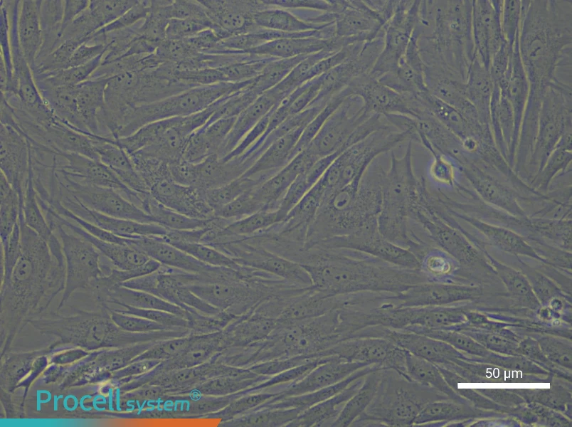 Human Gingival Fibroblast Complete Medium - small - 5
