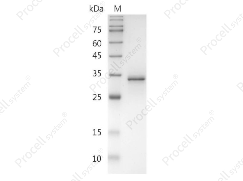 FasL/TNFSF6/CD95L/CD178, Human, Recombinant