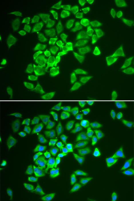 Immunofluorescence analysis of A549 cells using KEAP1 Polyclonal Antibody