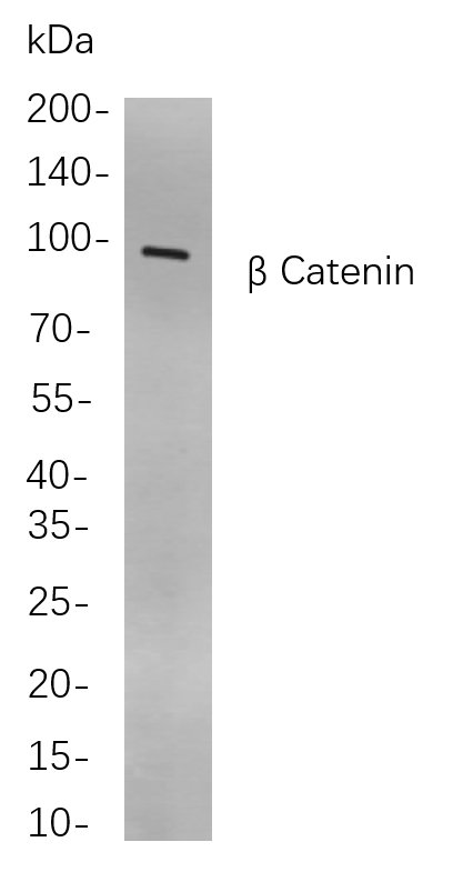 Recombinant β Catenin Monoclonal Antibody-searchlist-1