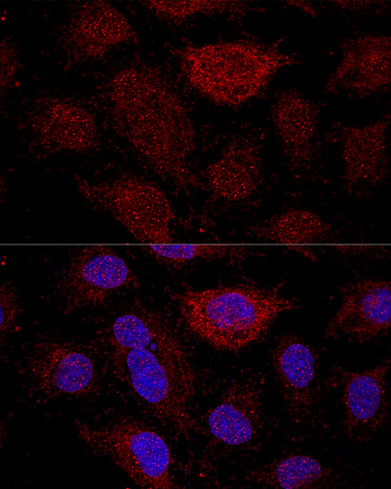 Confocal immunofluorescence analysis of HeLa cells using RPL21 Polyclonal Antibody at dilution of  1:200. Blue: DAPI for nuclear staining.