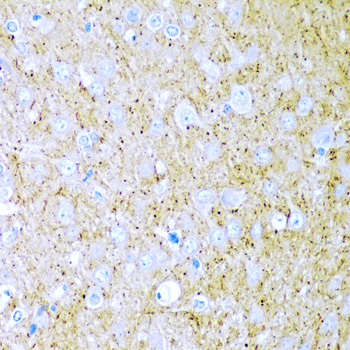 Immunohistochemistry of paraffin-embedded Rat brain using WNT2 Polyclonal Antibody at dilution of 1:200 (40x lens).
