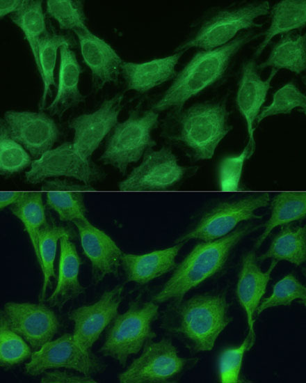 Immunofluorescence analysis of C6 cells using CNNM1 Polyclonal Antibody at dilution of 1:100. Blue: DAPI for nuclear staining.