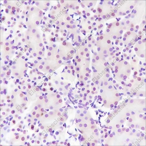 Recombinant Ataxin-3 Monoclonal Antibody - 2