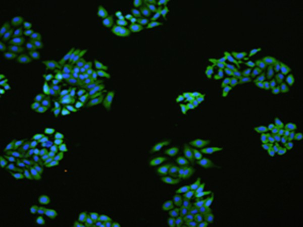 Immunofluorescence analysIs of HepG2 cell  using FLT4 Polyclonal Antibody at dilution of 1:100