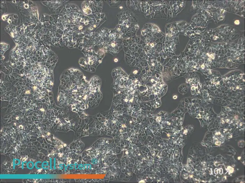 HuH-1 Cell Complete Medium - 1
