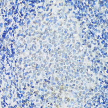 Immunohistochemistry of paraffin-embedded rat spleen using IKKε Polyclonal Antibody at dilution of 1:100 (40x lens).Perform microwave antigen retrieval with 10 mM PBS buffer pH 7.2 before commencing with IHC staining protocol.