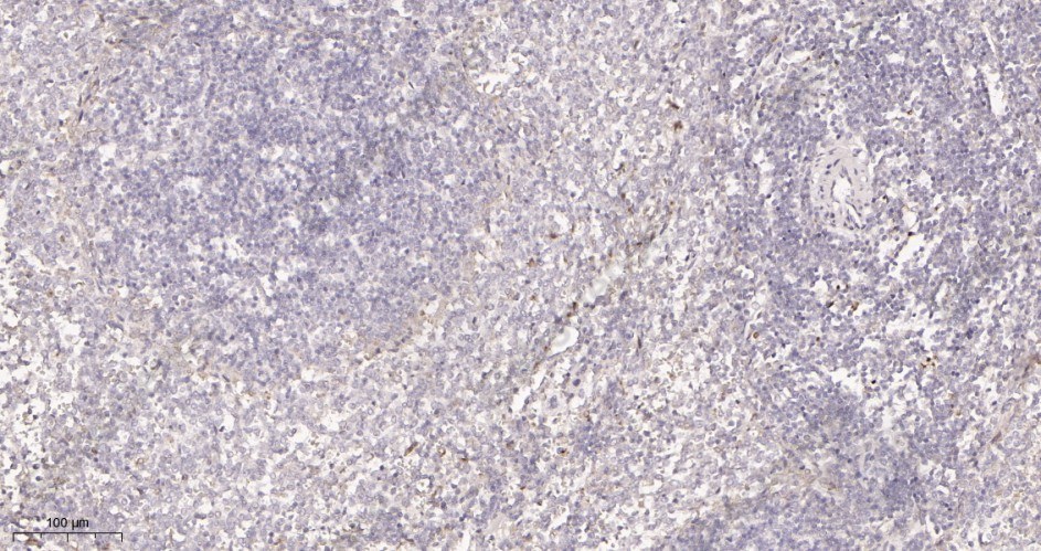 Recombinant FAK Monoclonal Antibody - 3