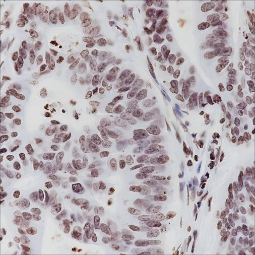 Recombinant ERCC1 Monoclonal Antibody - 3