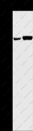 PYGL Polyclonal Antibody - 1