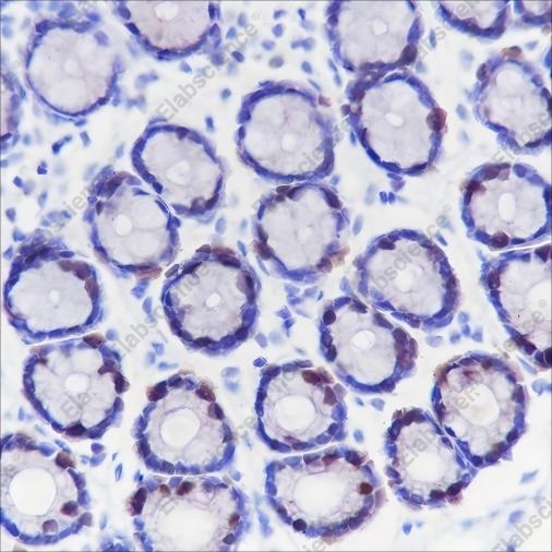 Recombinant TPX2 Monoclonal Antibody - 2