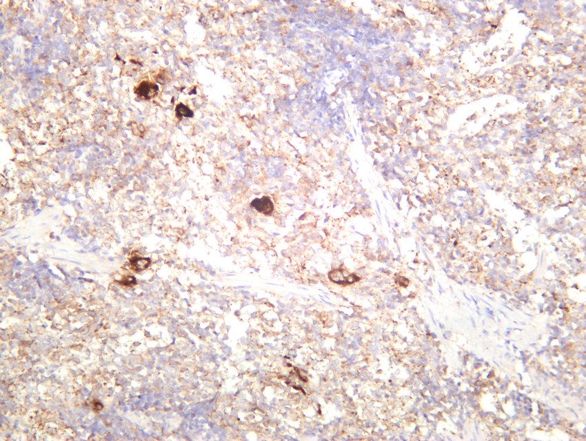 Recombinant TGF β1 Monoclonal Antibody - small - 5