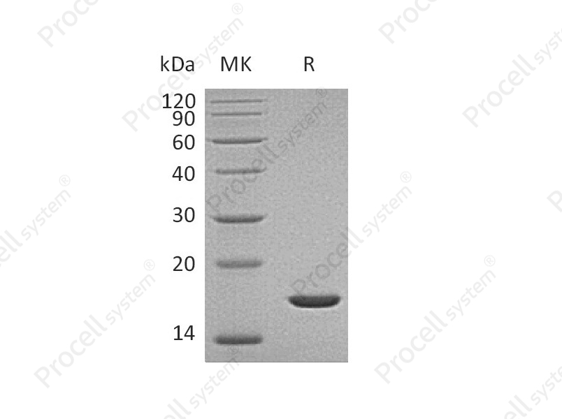 FGF-2/bFGF/FGF-b (Gly132-Ser288), Human, Recombinant
