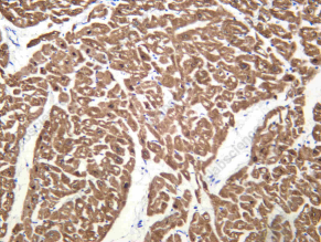 Recombinant PLB Monoclonal Antibody - 1