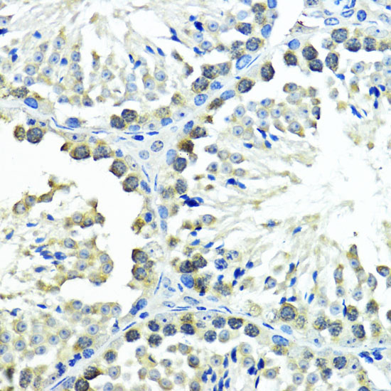 Immunohistochemistry of paraffin-embedded mouse testis using SUMO1 Polyclonal Antibody at dilution of 1:200 (40x lens).Perform microwave antigen retrieval with 10 mM PBS buffer pH 7.2 before commencing with IHC staining protocol.