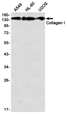 Western blot detection of Collagen I in A549,HL-60,U2OS using Collagen I Rabbit mAb(1:1000 diluted)