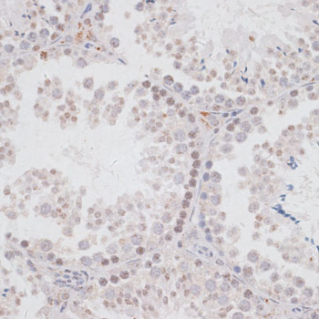 Immunohistochemistry of paraffin-embedded Mouse testis using KDM3A Polyclonal Antibody at dilution of 1:100 (40x lens).