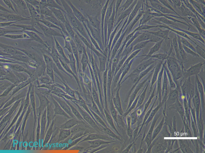 Human Pulmonary Artery Fibroblast Complete Medium - 5