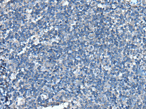 Immunohistochemistry of paraffin-embedded Human tonsil tissue  using UFC1 Polyclonal Antibody at dilution of 1:50(?200)