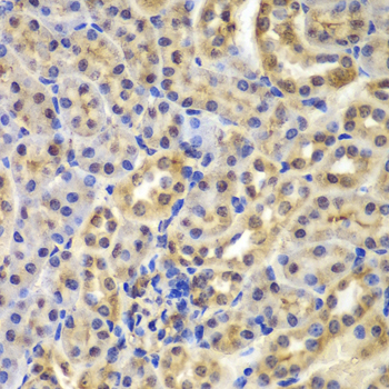 Immunohistochemistry of paraffin-embedded Mouse kidney using IKB alpha Polyclonal Antibody at dilution of 1:100 (40x lens).